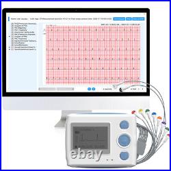 Professional Holter 12 Lead ECG Monitor with AI Analysis Work With Mac & Windows