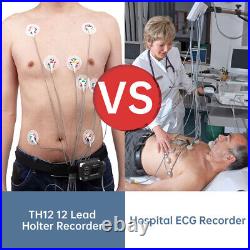 Professional Holter 12 Lead ECG Monitor with AI Analysis Work With Mac & Windows